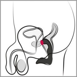 Wiederaufladbarer Prostata-Plug Rebel