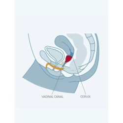 Fun Copa Vaginal Talla B Uvs